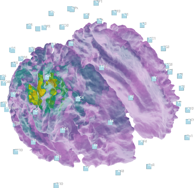 MEG Source Reconstruction (dark)