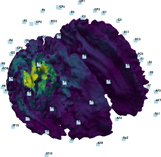 MEG Source Reconstruction (light)