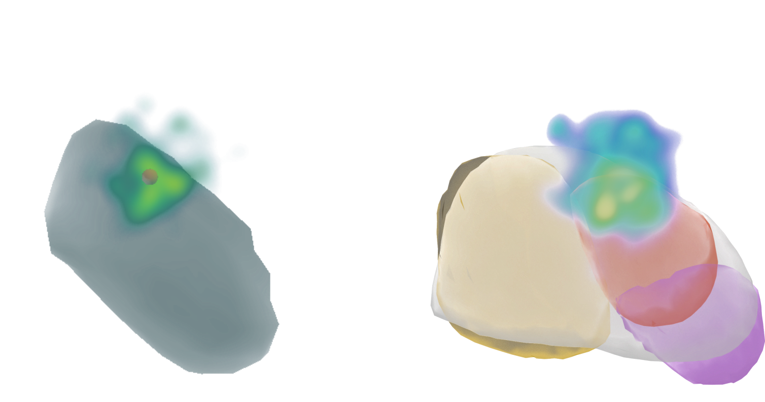 MEG Source Reconstruction (dark)