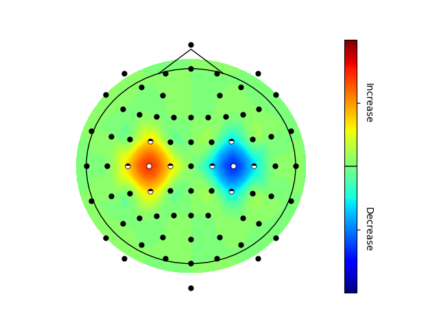 ../_images/topoplot.png